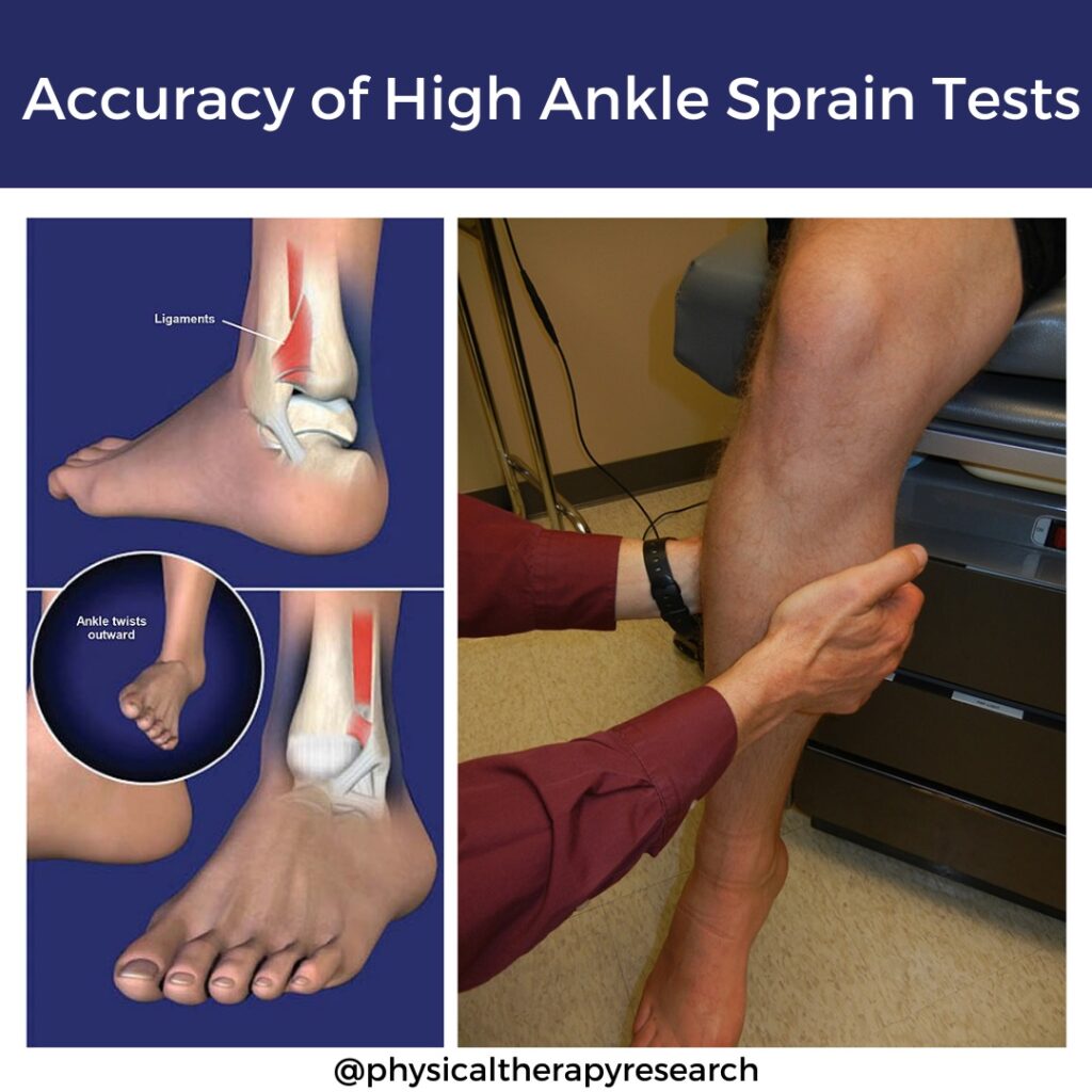 Accuracy of High Ankle Sprain Tests