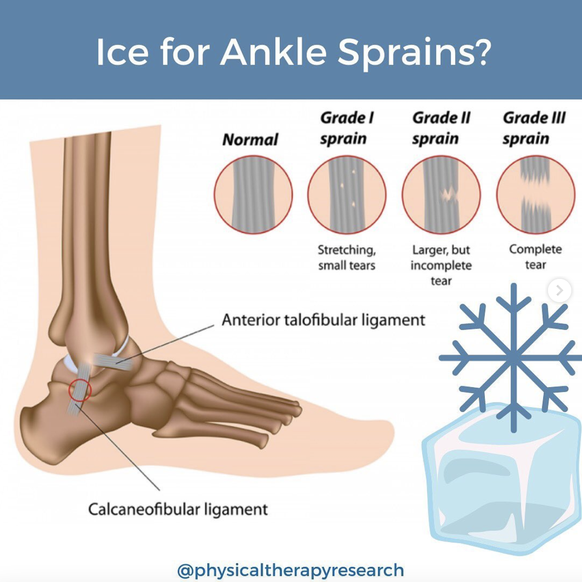 4-ways-to-ice-a-sprain-wikihow